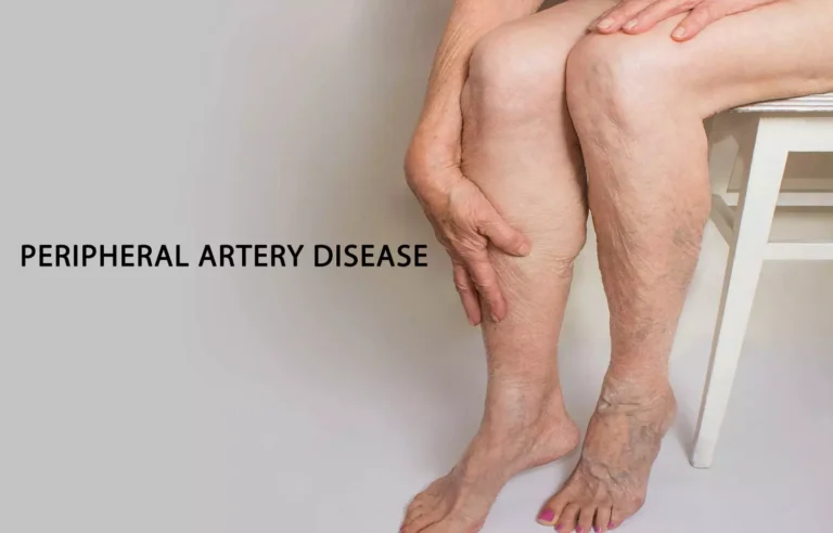 Reduce the symptoms of peripheral artery disease (Muscle cells)